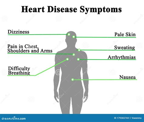 Symptoms Of Heart Disease Stock Photo Image Of Illness 179365744