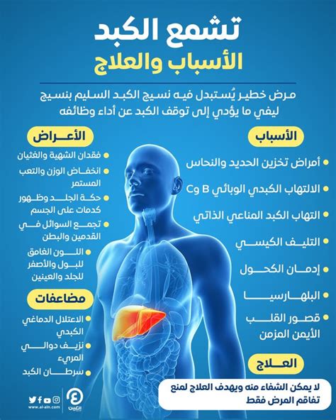 اعراض تليف الكبد