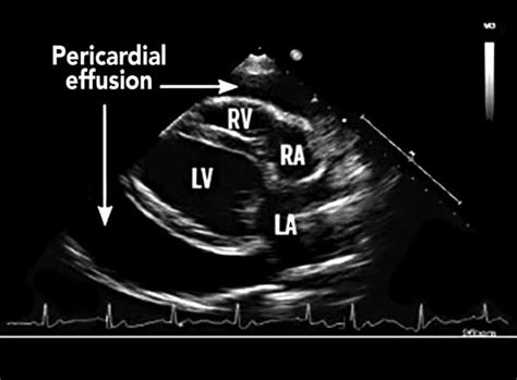 Responding To A Cardiac Emergency Pericardial Effusion In Canine