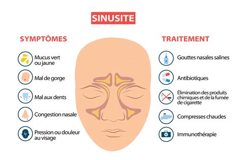 Sinusite Chronique Causes Signes Et Traitements
