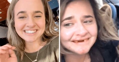 Girl Loses Front Teeth After Bottomless Mimosas • Instinct Magazine
