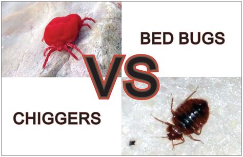 Chiggers Vs Bed Bugs In 10 Important Points Explained Y L P C