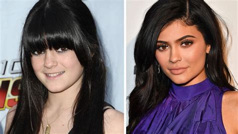 Kylie Jenner Before And After Check Out The Youngest Kardashian