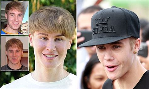 Justin Bieber Fan Toby Sheldon 33 Has 100k Of Plastic Surgery To