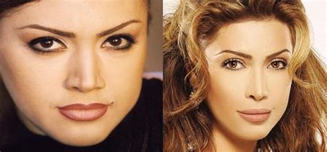 Nawal Before And After