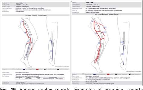 Duplex Ultrasound In The Assessment Of Lower Extremity Venous Free