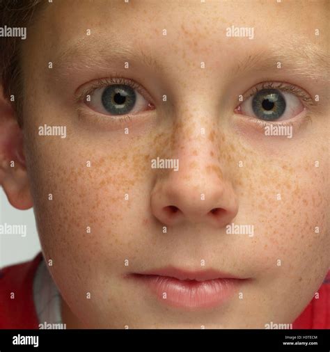 Boy Seriously Freckles Portrait Model Released Child Expression