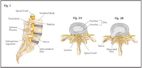 Spine Doctor Articles Asia Medical Specialists