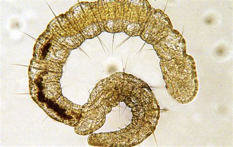 Microscopic Bristle Worm Project Noah