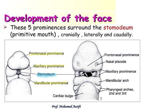 Development Of The Face Nose Palate
