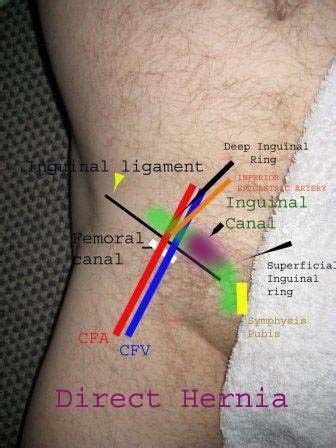 Normal Hip Groin Ultrasound How To Medical Ultrasound Ultrasound