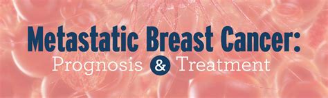 Metastatic Breast Cancer Prognosis And Treatment New York Health Works