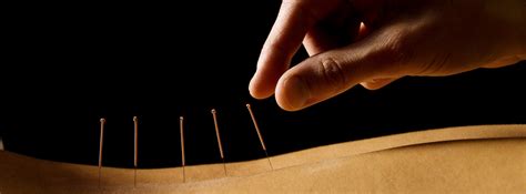 best acupuncture center for wellness in miami and miami beach florida