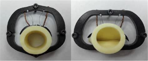 a novel artificial anal sphincter with constant force ios press