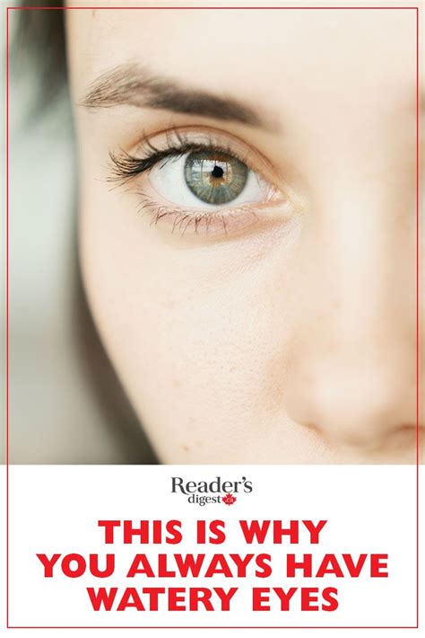 6 Reasons You Always Have Watery Eyes Watery Eyes Sensitive Teeth Eyes