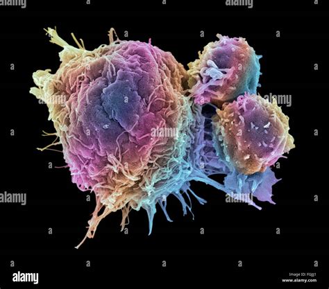 Linfociti T E Cellule Di Cancro Color Scanning Electron