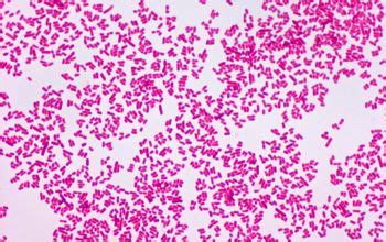 Salmonella Microscope Drug Resistant Salmonella Maybe Next Time