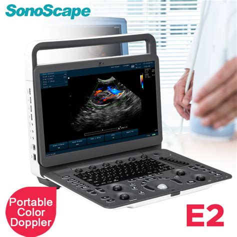 Sonoscape E2 Portable Color Doppler System 3d 4d Ultrasonido Doppler