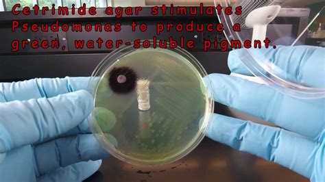 Using The Oxidase Test And Cetrimide Agar To Identify Pseudomonas Youtube