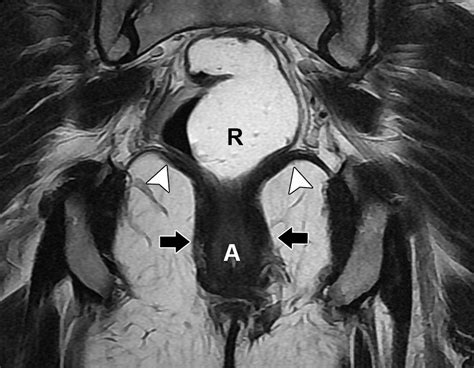 Mr Imagingbased Assessment Of The Female Pelvic Floor Radiographics