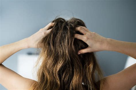 Six Reasons Why Your Scalp Might Be So Itchy
