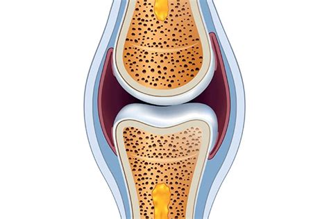 Synovial Fluid In Joints What It Is And How Exercise Affects It 220