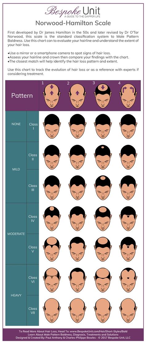 Norwood Hamilton Scale Hairloss Pattern Baldness Infographic Guide
