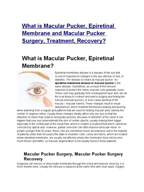 What Is Macular Pucker Epiretinal Membrane And Macular Pucker Surgery