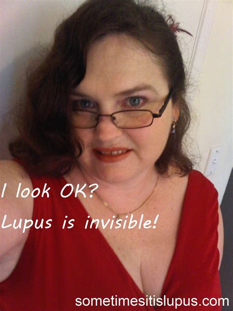 Sometimes It Is Lupus: Invisible Illness Vs Visible Illness