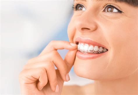 ¿qué Es La Ortodoncia Invisible Tks Clínica Dental