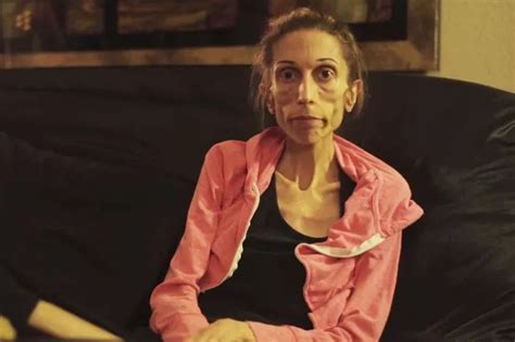 Rachael Farrokh Severely Anorexic Actress Takes First Steps One Month