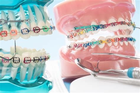 Premium Photo Orthodontic Model And Dentist Tool Demonstration Teeth Model Of Varities Of
