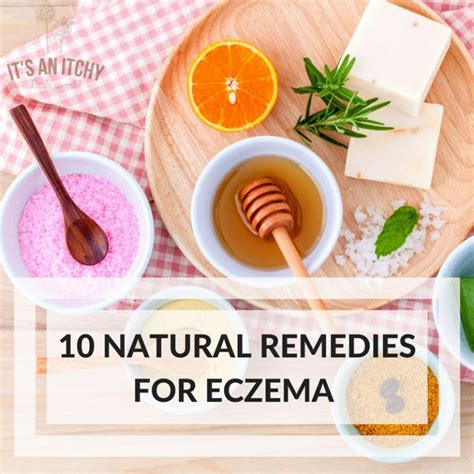 10 Natural Home Remedies For Eczema To Try At Home Today