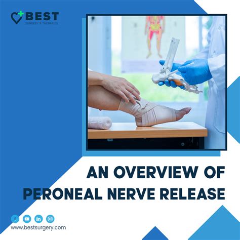 Peroneal Nerve Release