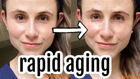 Vlog Rapid Skin Aging And La Roche Posay Dr Dray Aging Skin La Roche