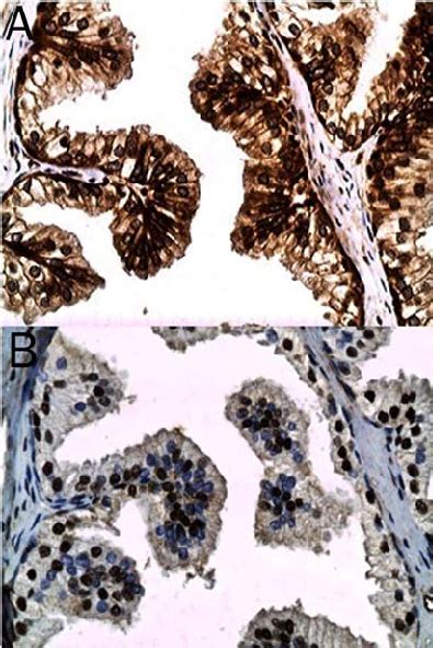 Non Neoplastic Glandular Epithelium From A Case Of Benign Prostatic
