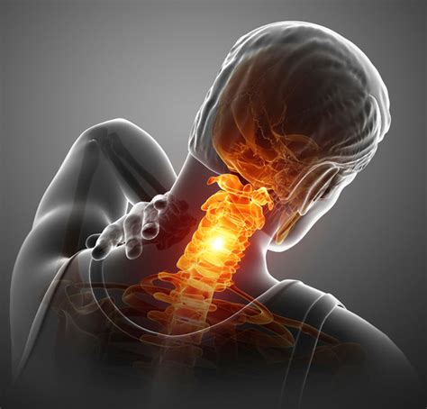 Most Common Causes Of Neck Pain