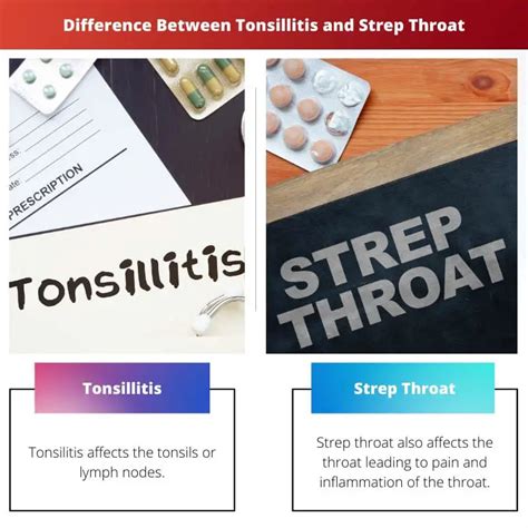 Tonsillitis Vs Strep Throat Difference And Comparison