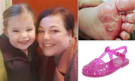 Hull Mother Claims Jelly Shoes Left Her Three Year Old Daughters Feet