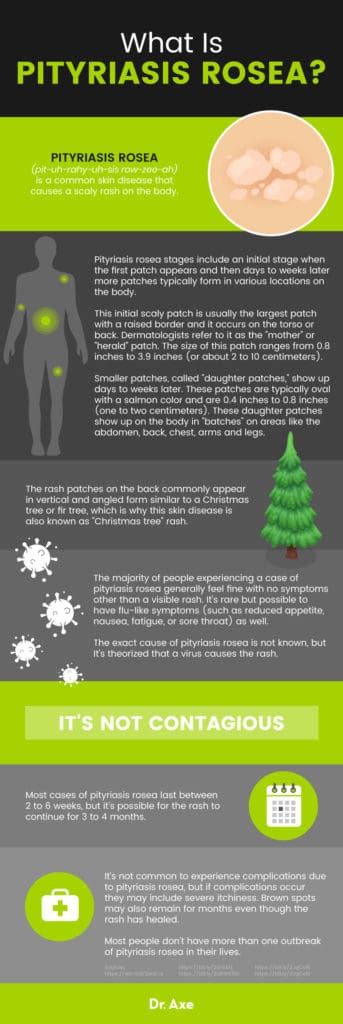 Pityriasis Rosea 6 Natural Ways To Help Treat Christmas Tree Rash