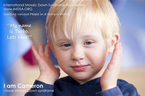 What Is Mosaic Down Syndrome Ahome Designing