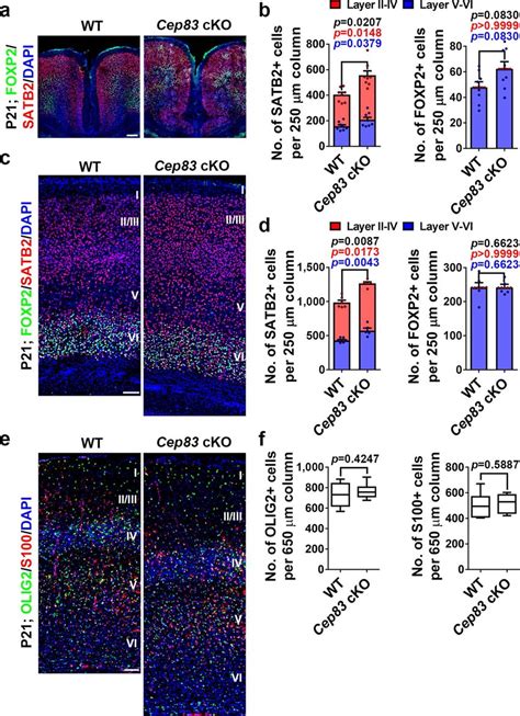 Deletion Of Cep83 In Rgps Leads To Increased Neurogenesis And