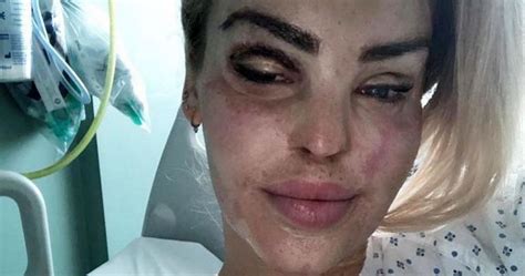 Katie Piper Shares Update From Hospital Bed After