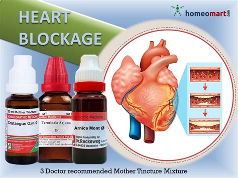 Heart Blockage Homeopathy Medicine Kit Homeopathy Remedies Online