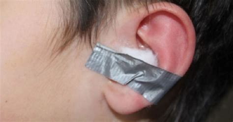 Taping A Cotton Ball On Your Ear Overnight Can Help You Reduce Ear Ache