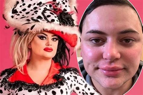 Rupauls Drag Race Uk Star Baga Chipz Unveils New Face After Undergoing
