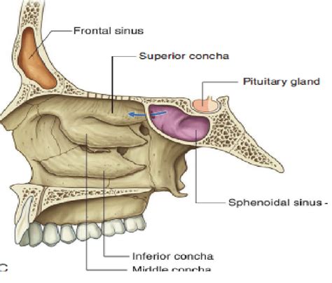 The Paranasal Sinuses Structure Function TeachMeAnatomy