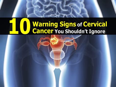 signs of cervical cancer 12 warning signs of cervical cancer every woman should know