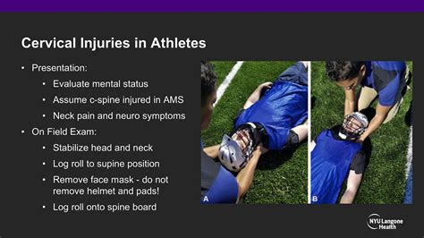 Concussion Burners Stingers Sports C Spine Injuries Abos Orthopedic Surgery Board Exam