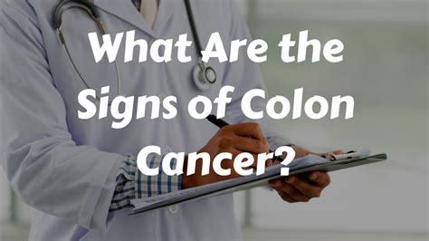 Colon cancer, which is likewise called colorectal disease, is the third driving reason for disease related passings in the two people in the united states. What are the Signs of Colon Cancer? - YouTube